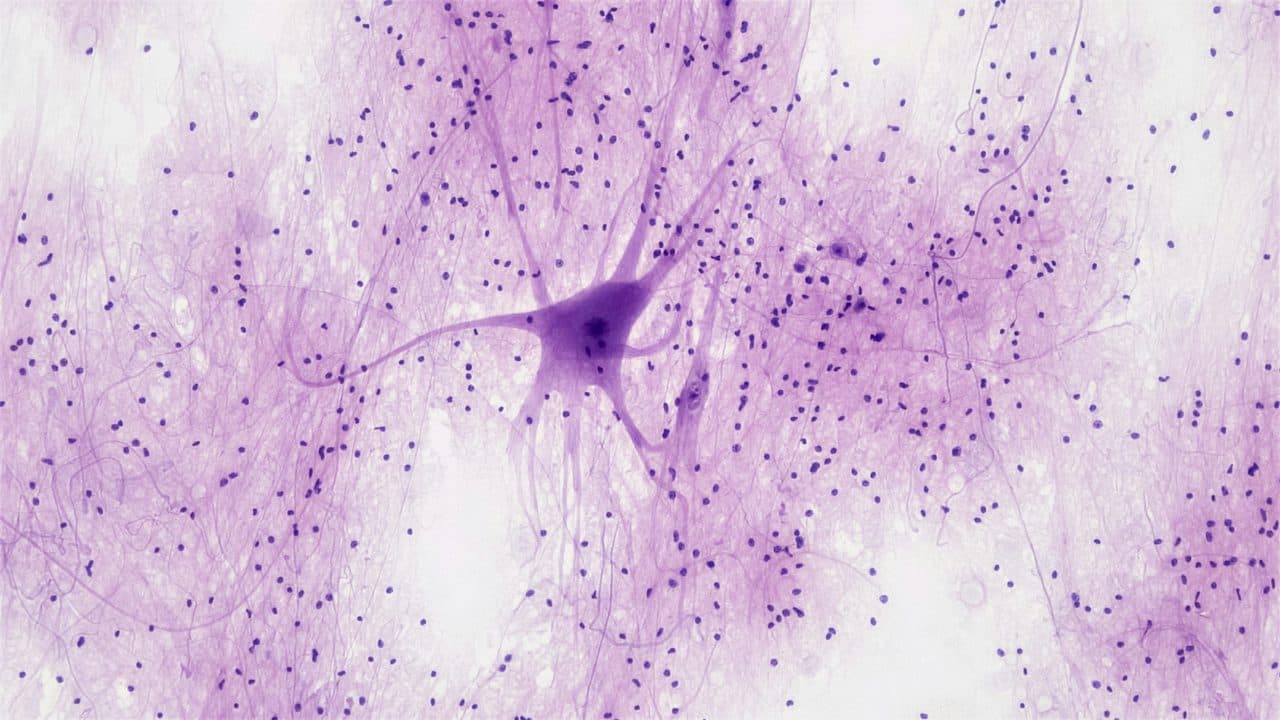Neurone coloré observé au microscope